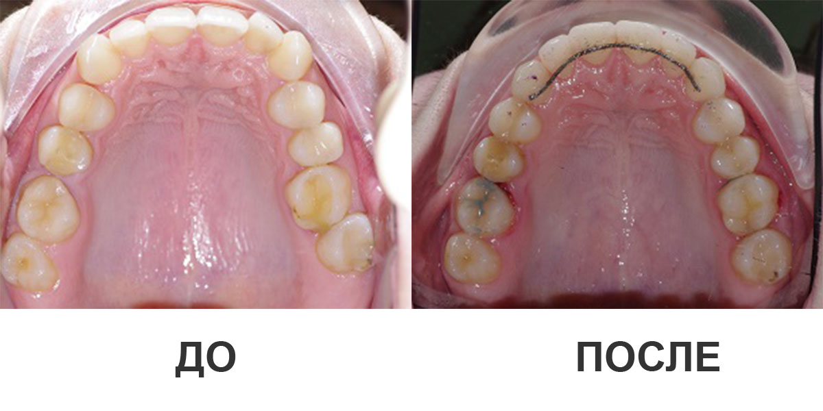 Примеры работ ортодонтов