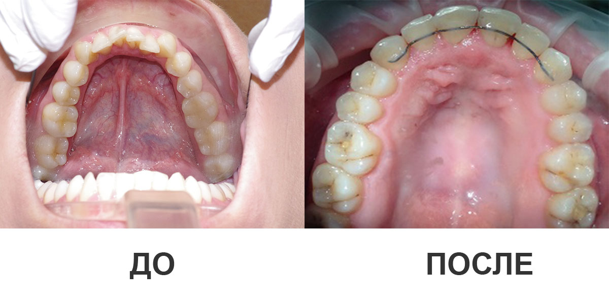 Примеры работ ортодонтов